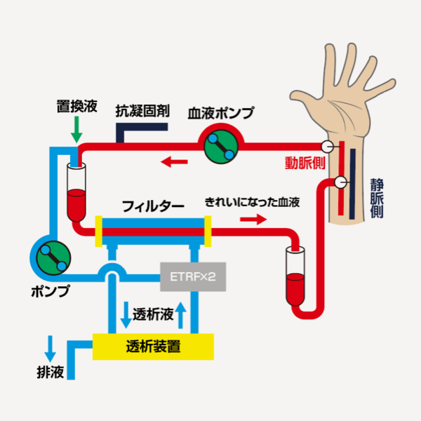 オンラインHDFとは