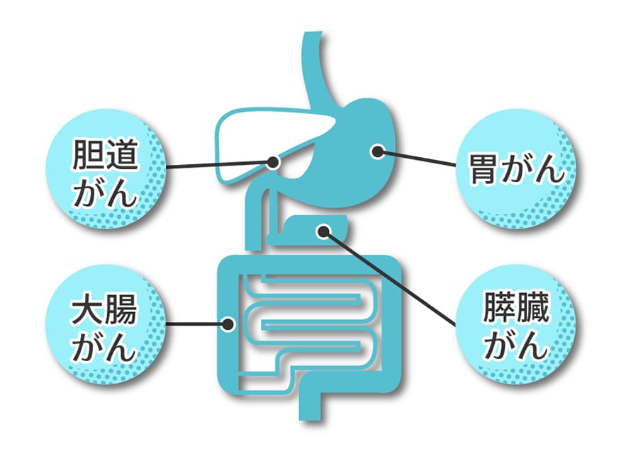 マイクアレイ血液検査の特徴